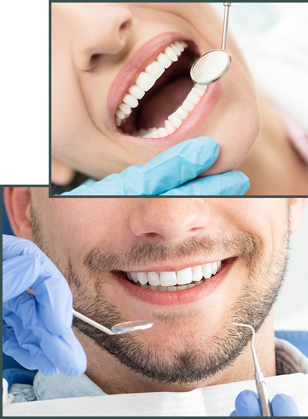 Teeth cleaning services at Comfort Dental Providence RI.